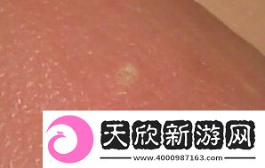 “小白点”奇谈
