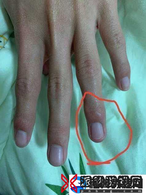 一根手指为何轻轻触碰就疼得如此厉害